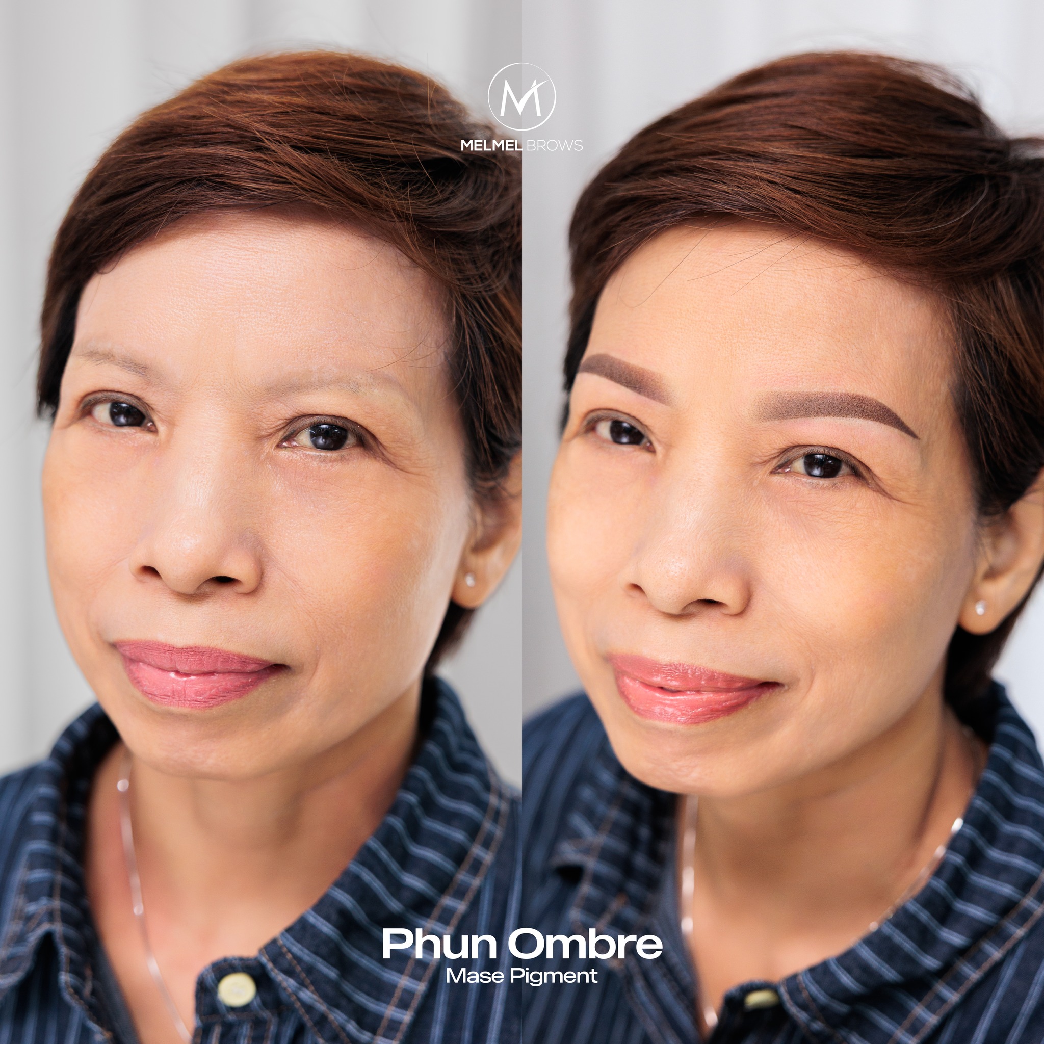 Hình ảnh trước sau